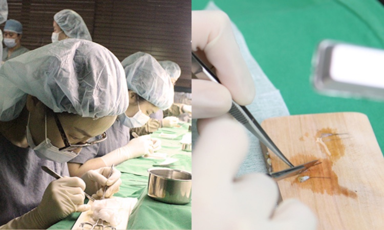 maxwell fue hair transplant korea