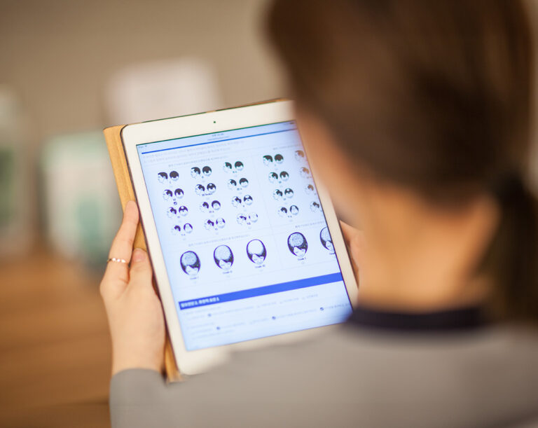 Hair Transplant Cost in Korea: Pricing Breakdown & How to Save Money Without Cutting Corners